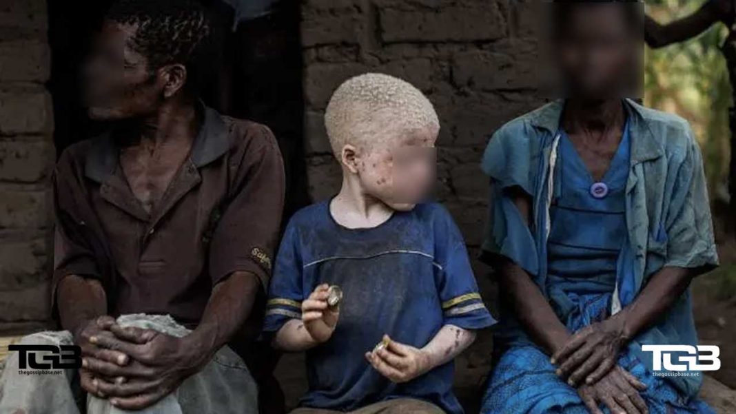 Mother-Albino-sales